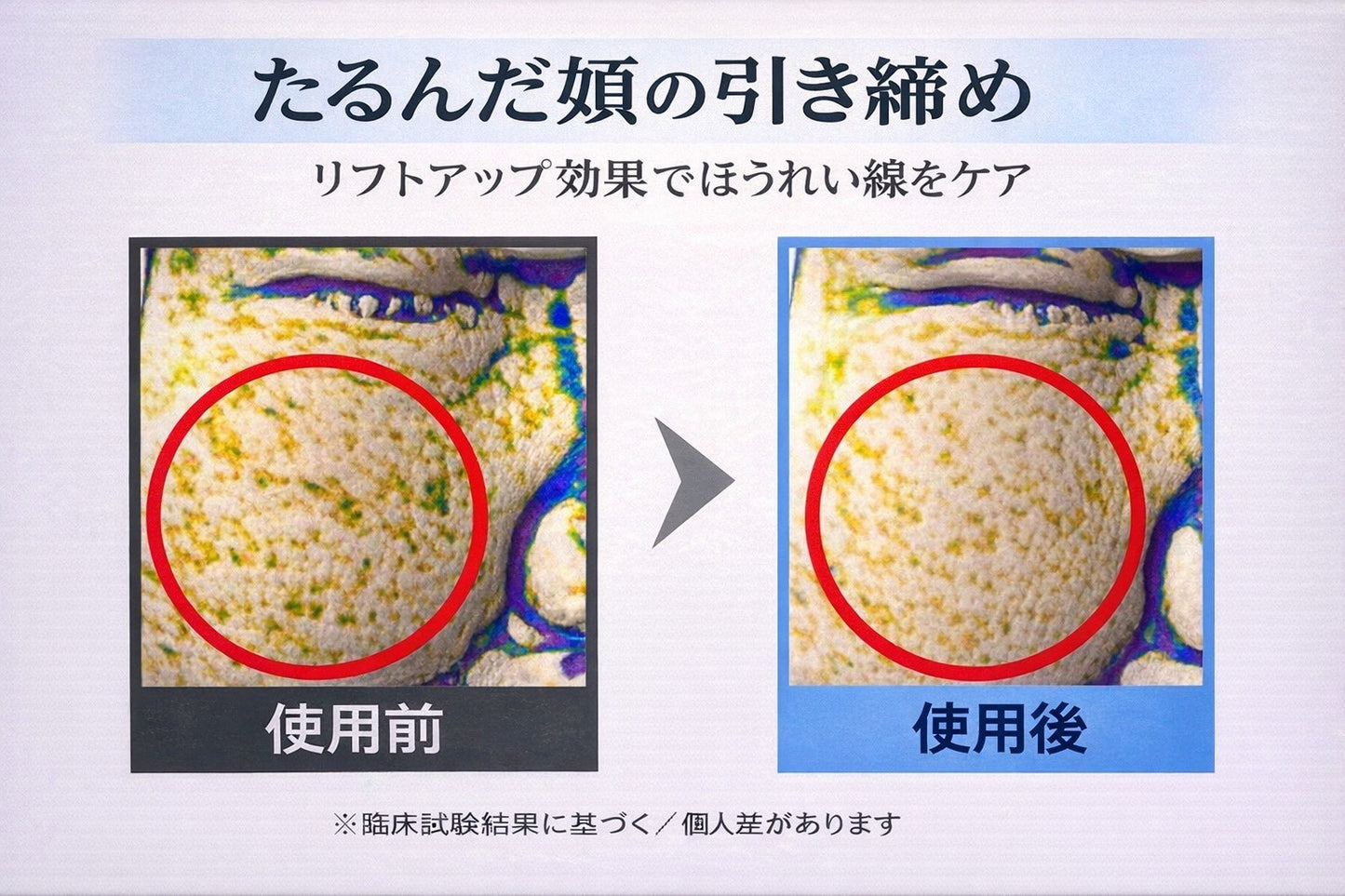 ダブリュースキントリートメントファクト本品（ピーチ、ラテ）