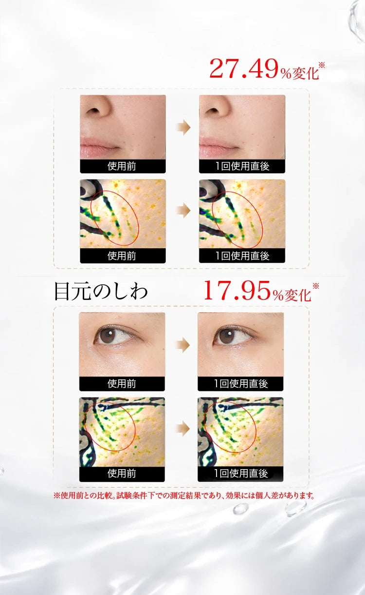 ほうれい線と目元のしわの改善データ