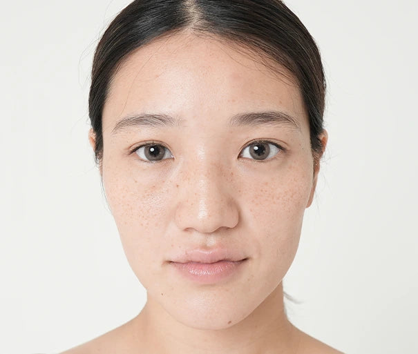 使用前の肌